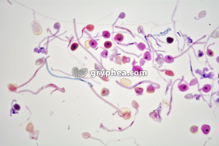 Germination pollen de Lys x15 - gryphea.com